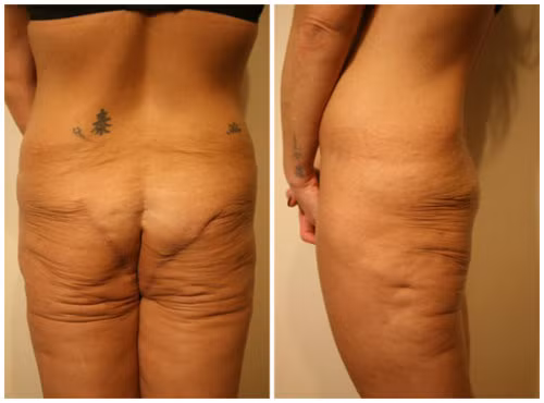 Những biến chứng thẩm mỹ kinh dị nhất nửa đầu năm 2015