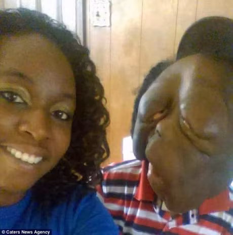 Cau be bi goi la quai vat vi khoi u khong lo che kin mat - Anh 3