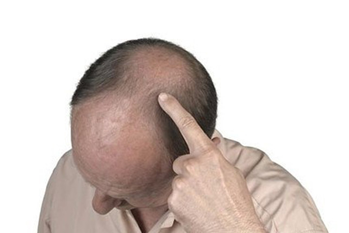 6 loại thực phẩm giúp nam giới không bao giờ sợ... hói
