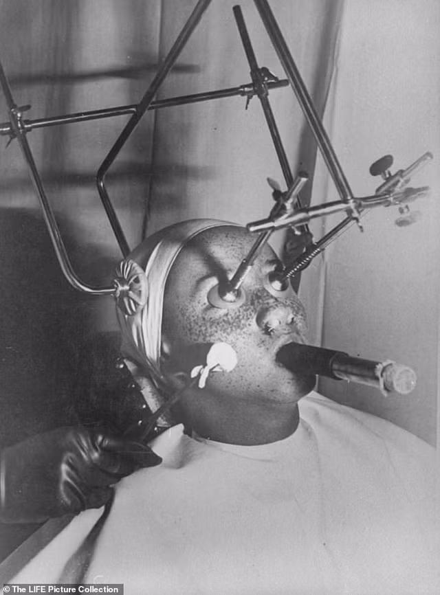 Một người phụ nữ đang trải qua liệu pháp xóa tàn nhang.