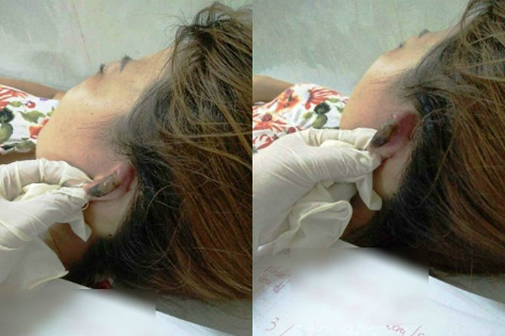 Tính mạng bị đe dọa vì… làm tóc