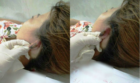 Tính mạng bị đe dọa vì… làm tóc - Ảnh 1 Tinh mang bi de doa vi… lam toc - Anh 1