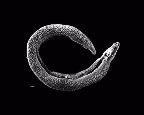 Những hình ảnh khủng khiếp về ký sinh trùng trên cơ thể người