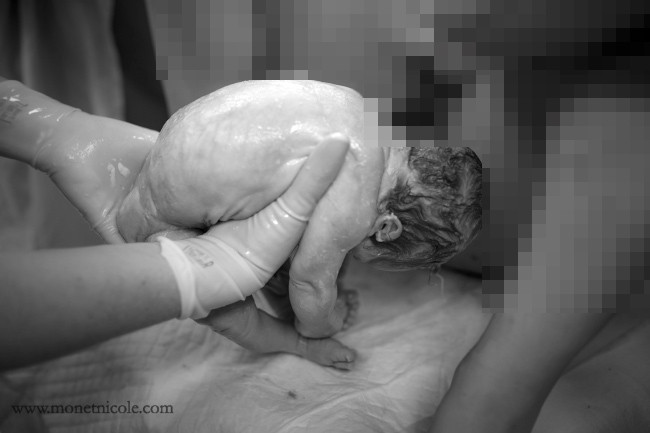 Tận mắt ca sinh thường thai nhi ngôi ngược ảnh 8 Tận mắt ca sinh thường thai nhi ngôi ngược ảnh 8