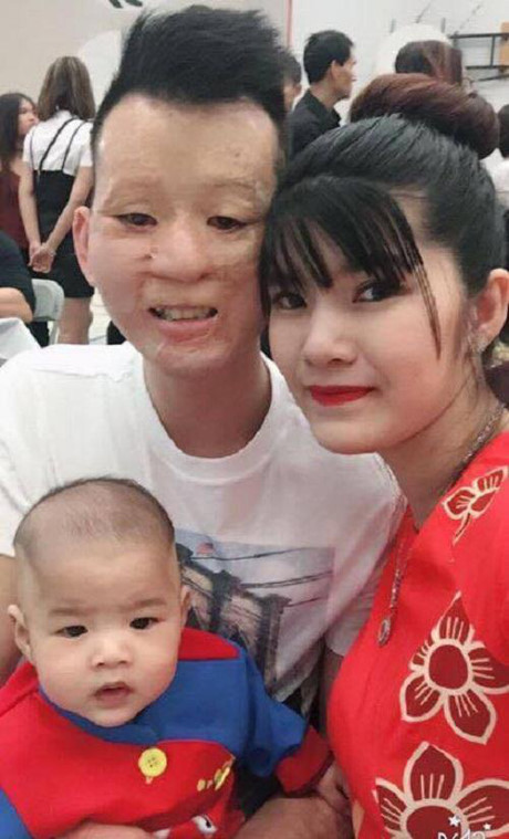 Khoe ảnh cận mặt con trai, cặp chồng xấu vợ xinh khiến dân mạng sốc - Ảnh 4 Khoe anh can mat con trai, cap chong xau vo xinh khien dan mang soc - Anh 4