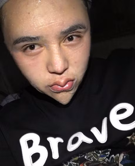 Lo guong mat that cua 