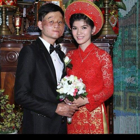 Khoe ảnh cận mặt con trai, cặp chồng xấu vợ xinh khiến dân mạng sốc - Ảnh 1 Khoe anh can mat con trai, cap chong xau vo xinh khien dan mang soc - Anh 1