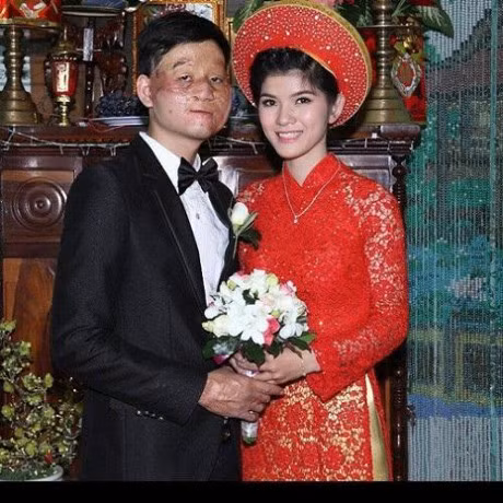 Khoe anh can mat con trai, cap chong xau vo xinh khien dan mang soc - Anh 1