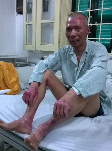 Ông Thảo may mắn thoát chết