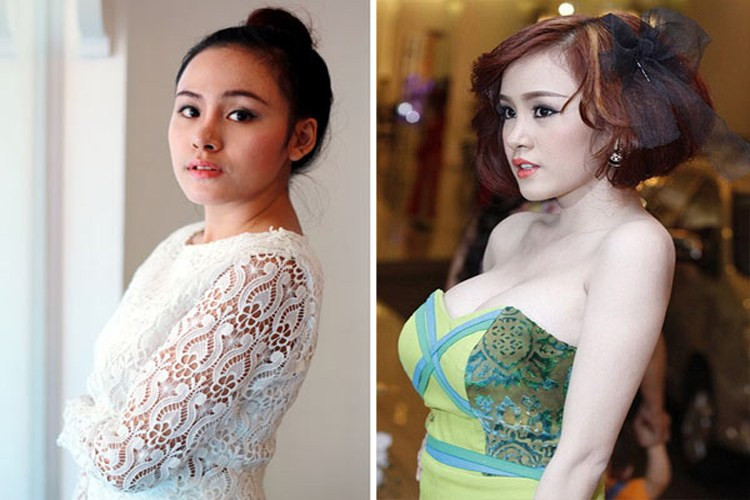 Người đẹp Việt nhan sắc tụt dốc vì dao kéo ảnh 8 Người đẹp Việt nhan sắc tụt dốc vì dao kéo ảnh 8