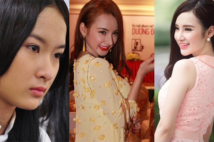 Người đẹp Việt nhan sắc tụt dốc vì dao kéo ảnh 4 Người đẹp Việt nhan sắc tụt dốc vì dao kéo ảnh 4