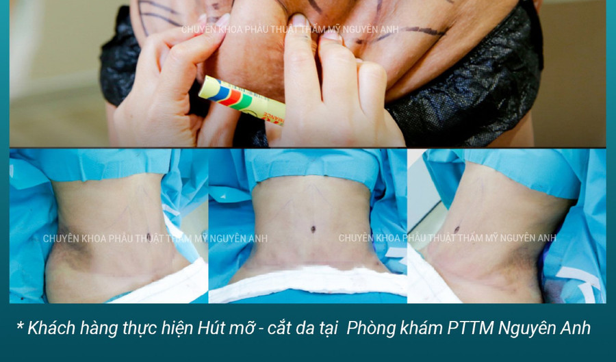 Làm rõ các hoạt động chuyên môn đối với ê-kíp nhân viên y tế thực hiện phẫu thuật cho chị Đ. (Ảnh: CMH)