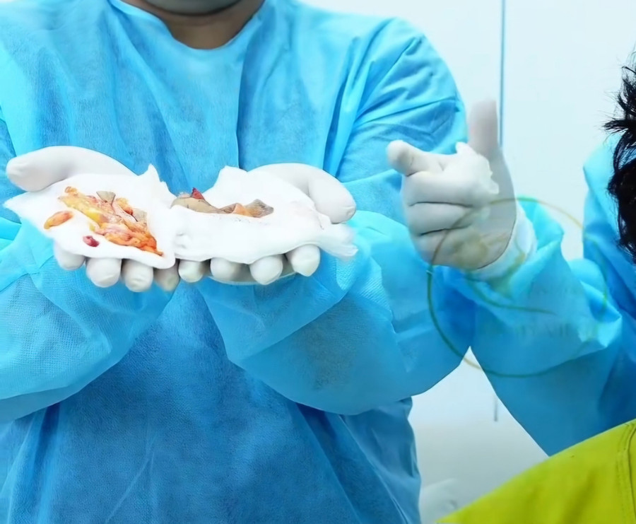 Tài khoản Facebook “ToNy An An”, “Thẩm mỹ viện ToNy An An”, “Phòng khám Thẩm mỹ Quốc tế HanJin” có đăng tải các nội dung quảng cáo phẫu thuật thẩm mỹ như căng chỉ, hút mỡ, cấy mỡ tự thân… (Ảnh: CMH)