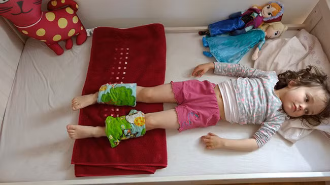 Phương pháp “buộc khăn làm mát” được coi là một trong những kiến thức sơ cứu cơ bản cho trẻ tại Đức (Ảnh minh họa).