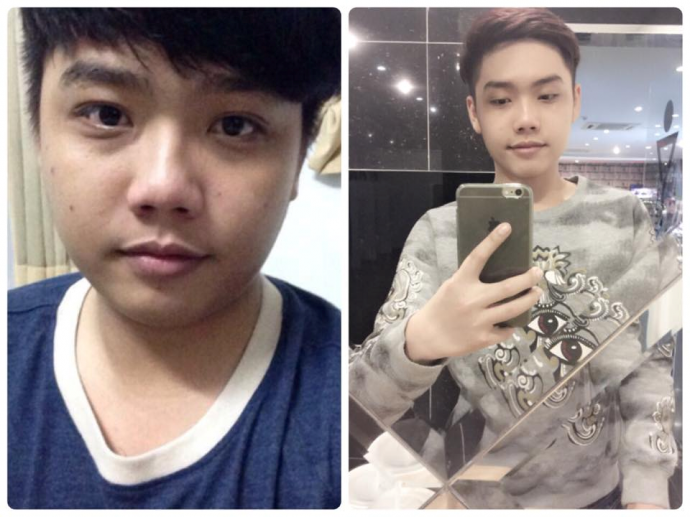 Chu Trịnh Đình Hoài Bảo trước và sau khi giảm cân- Ảnh: Mỹ Dung Chu Trinh Dinh Hoai Bao truoc va sau khi giam can