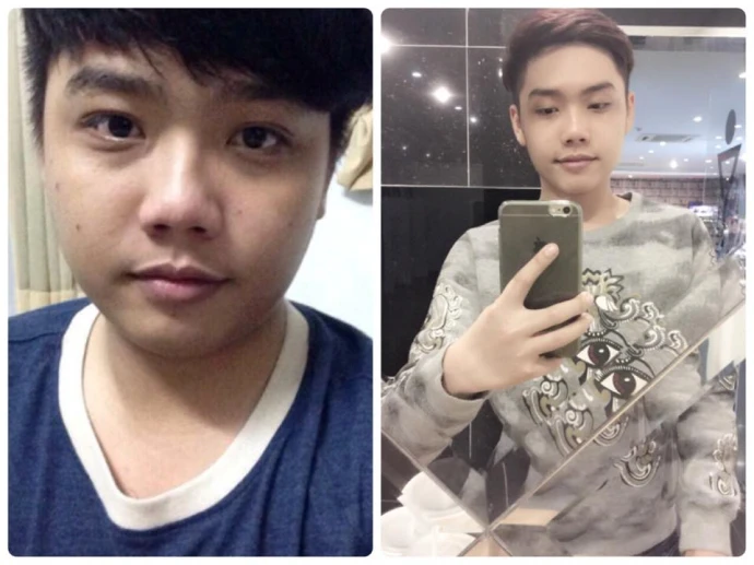 Chàng béo giảm 31 kg để trở thành hot boy