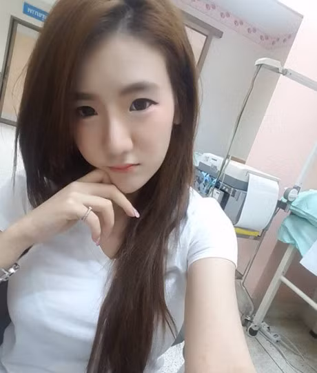 Bi dao dien 