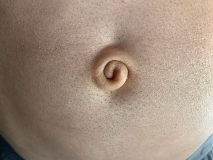 Chiếc rốn này tạo thành một hình xoắn ốc hoàn hảo.