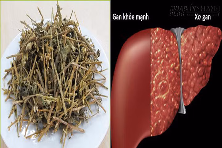 Người viêm gan mạn tính và xơ gan uống cây thuốc này là khỏe ngay
