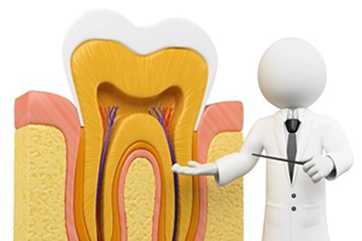 Triệu chứng của bệnh viêm tủy răng cấp tính