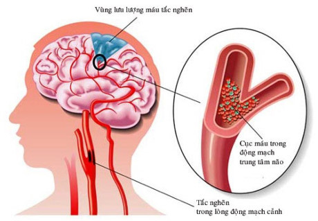 Bạn sẽ bất ngờ trước những tác dụng tuyệt vời của loài cây có nguồn gốc xứ lạnh này! - Ảnh 2 Ban se bat ngo truoc nhung tac dung tuyet voi cua loai cay co nguon goc xu lanh nay! - Anh 2