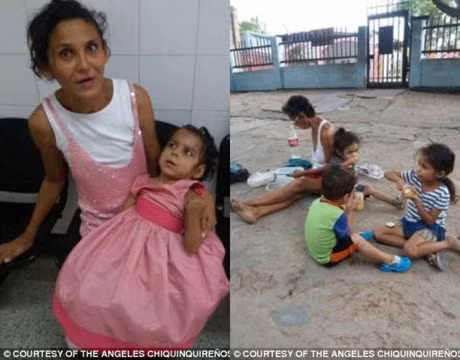 Su that tham khoc tai Venezuela hien ra qua buc anh em be thieu doi, gay tro xuong - Anh 2