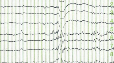Nghien cuu dung song nao lam mat khau - Anh 1