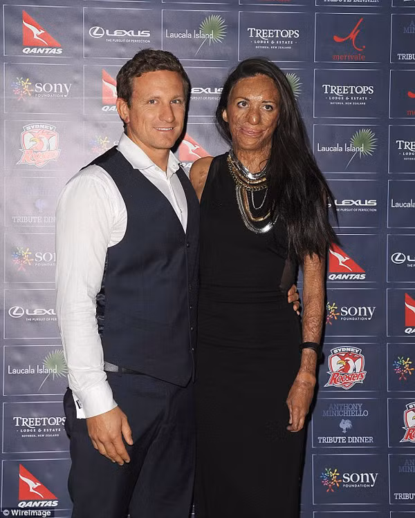 Những hình ảnh mới nhất về chuyện tình của cô gái có khuôn mặt quỷ dữ