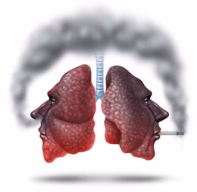 Neu khong muon bi ung thu phoi, hay lam nhung viec nay de bao ve phoi ngay tu bay gio - Anh 3