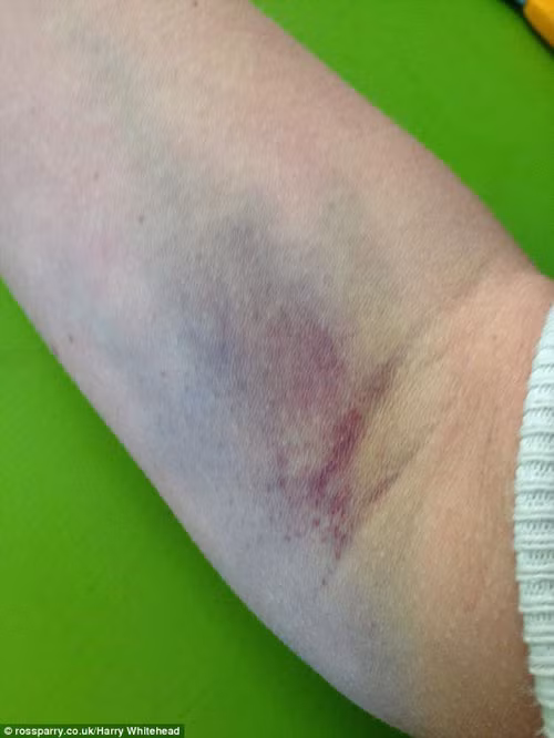 Xúc động hành trình thụ thai của mẹ bị tắc vòi trứng - 6