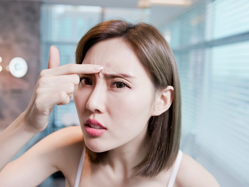 Bạn có thể hiểu được sức khỏe tổng thể của mình dựa trên vị trí nổi mụn trên gương mặt. Ảnh: boa forma. Bạn có thể hiểu được sức khỏe tổng thể của mình dựa trên vị trí nổi mụn trên gương mặt. Ảnh: boa forma.
