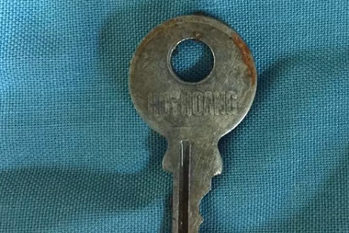 Chiếc chìa khóa cháu T nuốt phải trong lúc nô đùa. Ảnh: V.Nhị