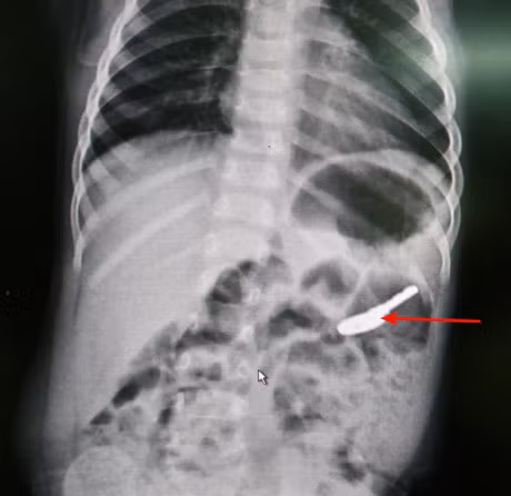 Nguoi dan Quang Ninh hoang so khi biet con nuot phai chia khoa - Anh 2