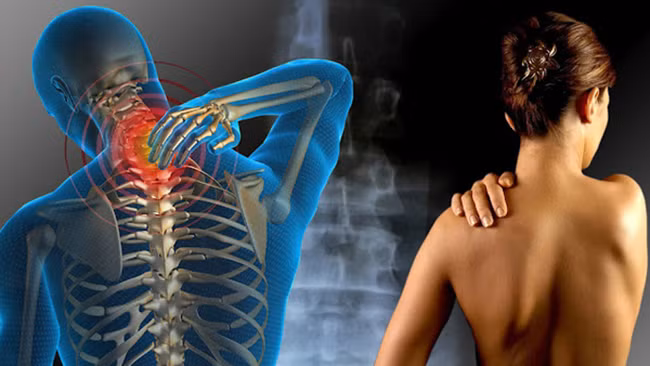 Dấu hiệu đau xơ cơ cực kì nguy hiểm đối với sức khỏe nhưng nhiều người hay phớt lờ