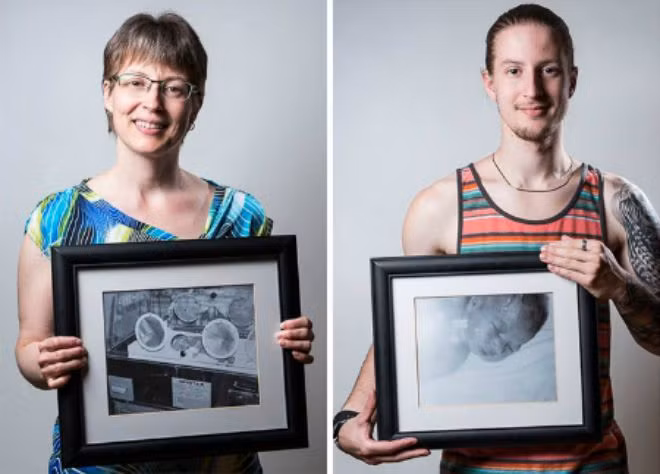 Cuộc đời tưởng đã mất của những đứa trẻ sinh non ảnh 6