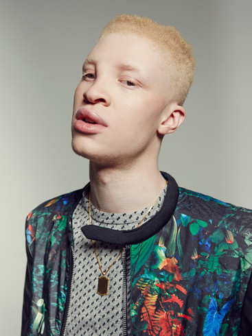 Shaun Ross là người mẫu bạch tạng nam đầu tiên trên thế giới.