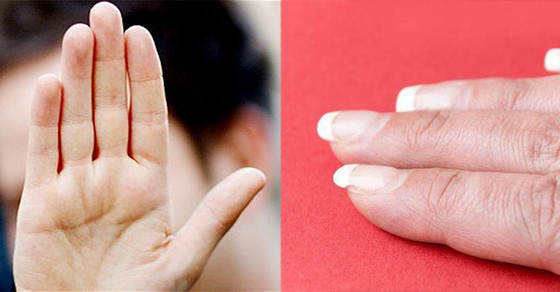 4 vùng có màu trắng báo hiệu cơ thể suy yếu, dễ đau ốm bệnh tật