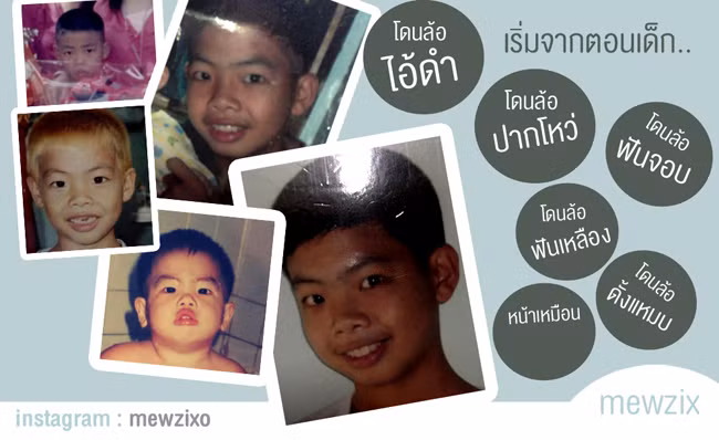 Hot boy Thái Lan khoe ảnh phẫu thuật cả hàm răng gây sốc - Ảnh 2