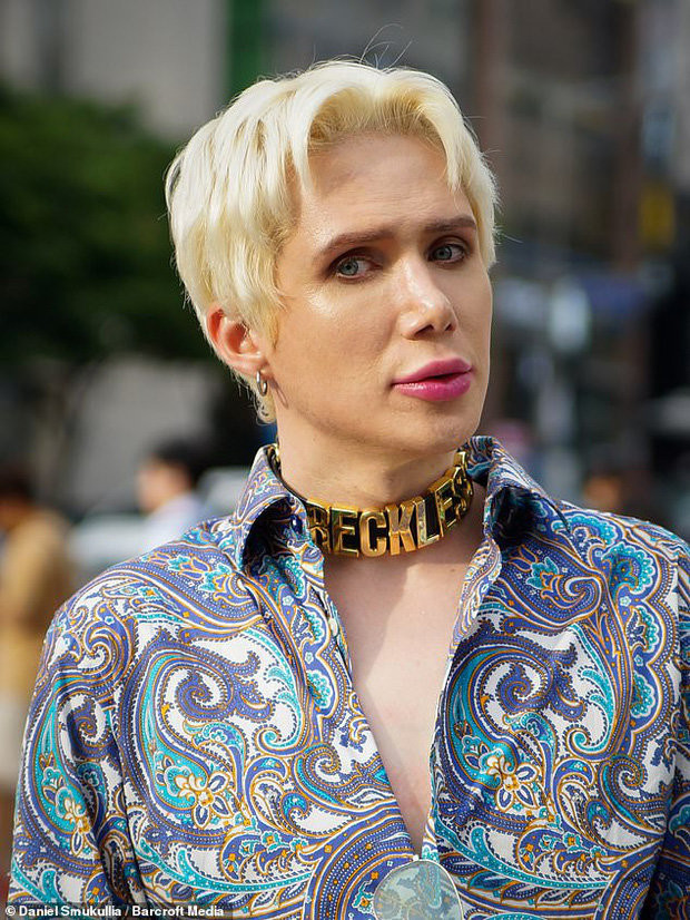 Fan cuồng bỏ ra 3,5 tỷ phẫu thuật thẩm mỹ trong suốt 6 năm để giống Jimin (BTS) ảnh 1 Và sau khi phẫu thuật thẩm mỹ để giống Jimin (BTS)