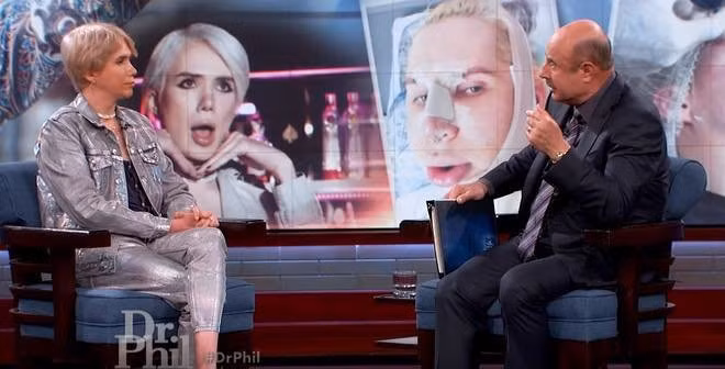 Fan cuồng người Anh chia sẻ câu chuyện về phẫu thuật thẩm mỹ giống idol Jimin (BTS)