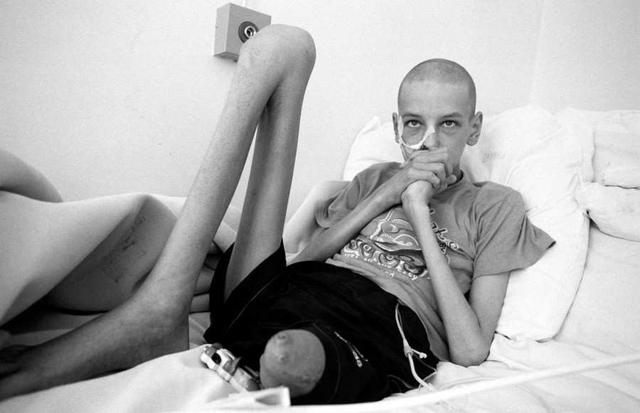 Tuy nhiên, điều xót xa nhất ám ảnh nhân loại là thảm kịch để lại hậu quả vô cùng lớn đối với nhiều thế hệ. Vova, 15 tuổi, điều trị tại Bệnh viện Ung thư Trẻ em ở thành phố Minsk năm 2000. Nhiều đứa trẻ mắc dị tật hoặc bệnh nguy hiểm như ung thư ngay từ khi chào đời vì cha, mẹ nhiễm phóng xạ từ vụ nổ ở nhà máy điện nguyên tử Chernobyl. Ảnh: Paul Fusco/Magnum Photos