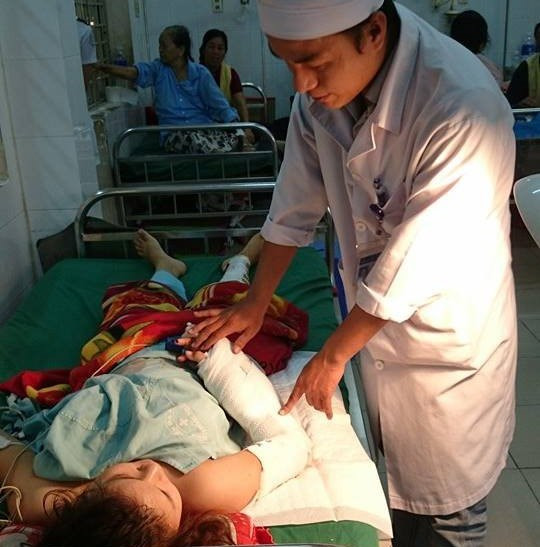 Nối thành bàn tay của công nhân gỗ bị máy cắt đứt lìa ảnh 1