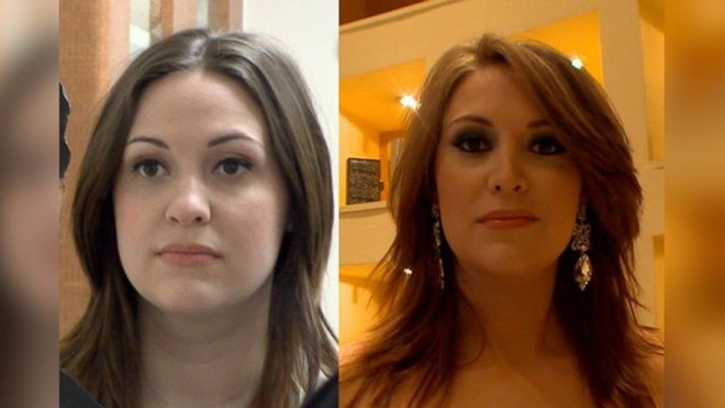 13 phi vụ dao kéo kỳ quặc nhất 2014