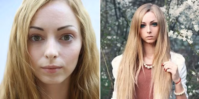 13 phi vụ dao kéo kỳ quặc nhất 2014