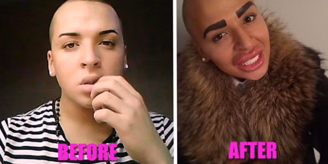 13 phi vụ dao kéo kỳ quặc nhất 2014