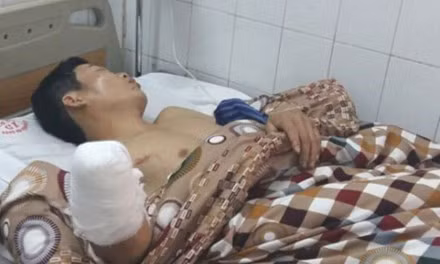 130 ca cap cuu do phao no - Anh 1