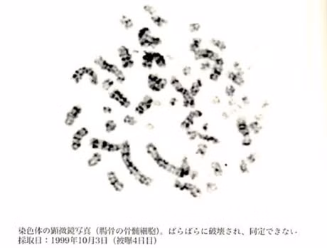 Suc song manh liet cua nguoi dan ong nhiem phong xa nhieu nhat trong lich su - Anh 2