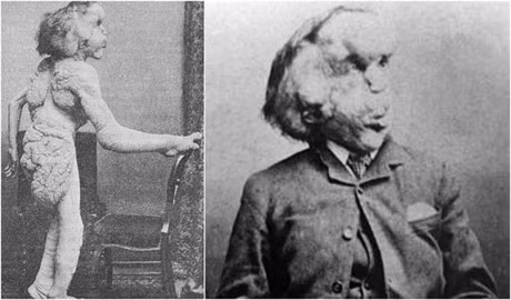 Bi an ve cuoc doi cua nguoi dan ong dau kho nhat the gian: Nguoi Voi - Anh 1