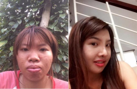 Sau phẫu thuật, bà mẹ đơn thân xấu như Thị Nở tự tin xuất hiện ở chốn đông người - Ảnh 1 Sau phau thuat, ba me don than xau nhu Thi No tu tin xuat hien o chon dong nguoi - Anh 1