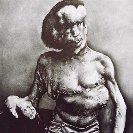 Bi an ve cuoc doi cua nguoi dan ong dau kho nhat the gian: Nguoi Voi - Anh 9